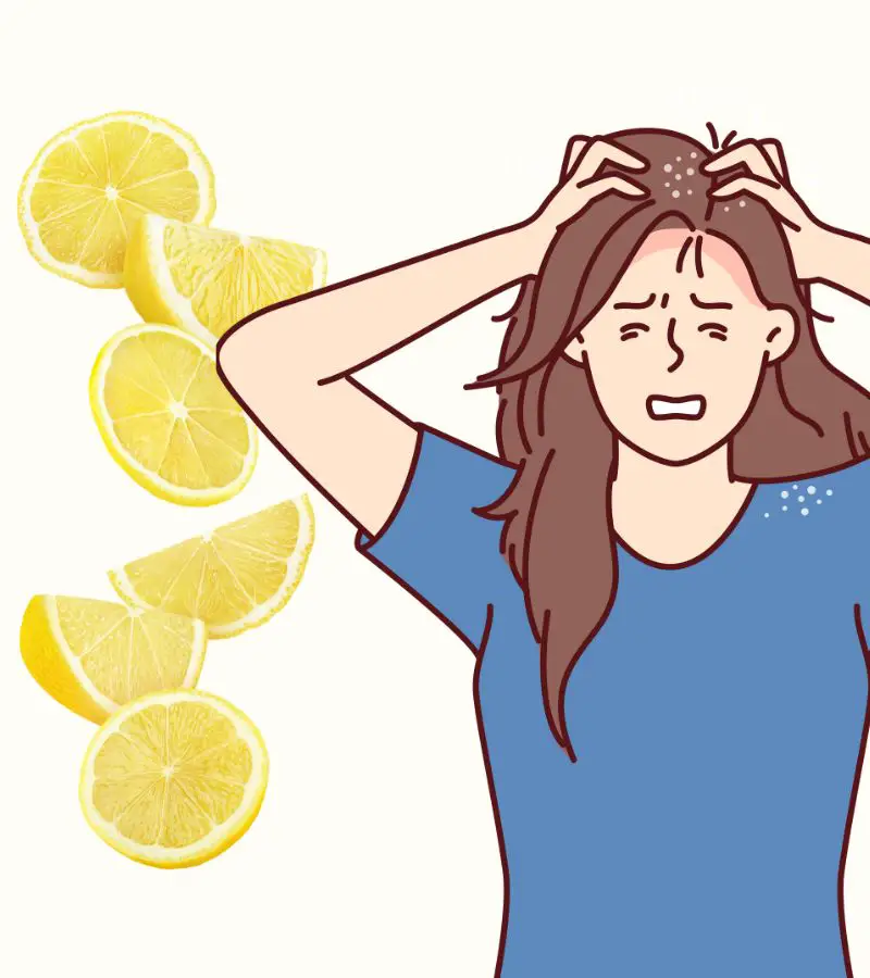 how to apply lemon on hair for dandruff