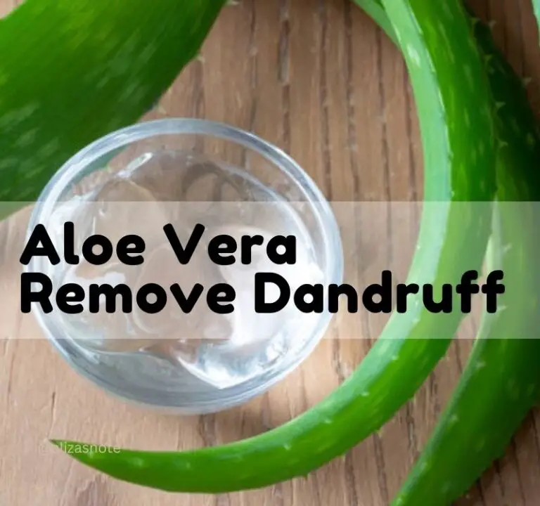 Can Aloe Vera Remove Dandruff Permanently