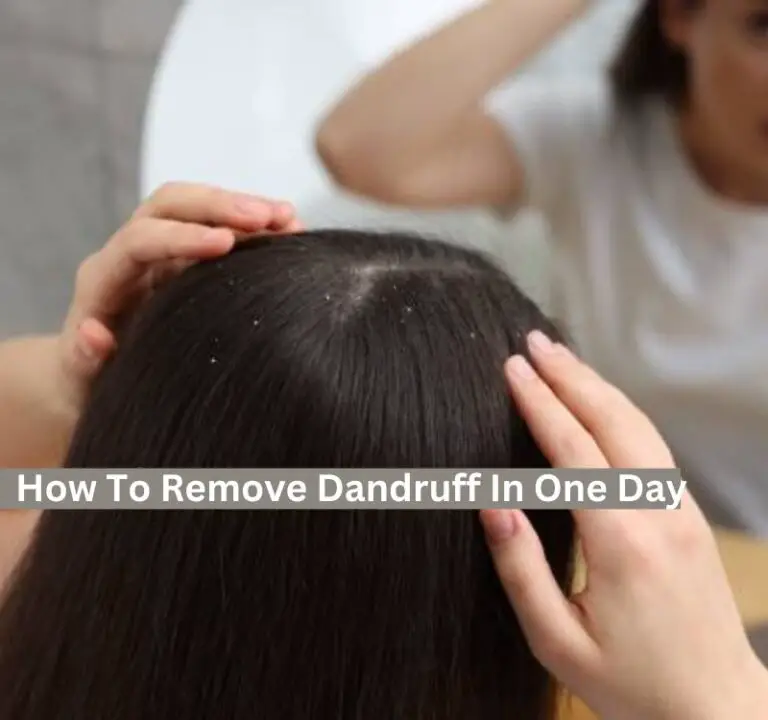 How To Remove Dandruff In One Day Home Remedies