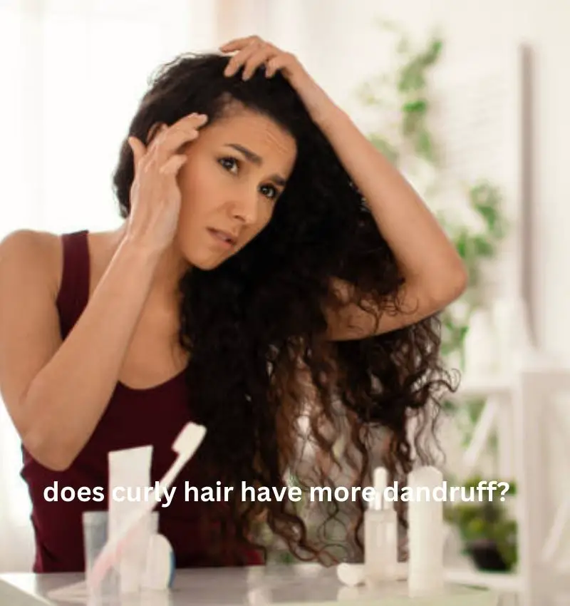  does curly hair have more dandruff