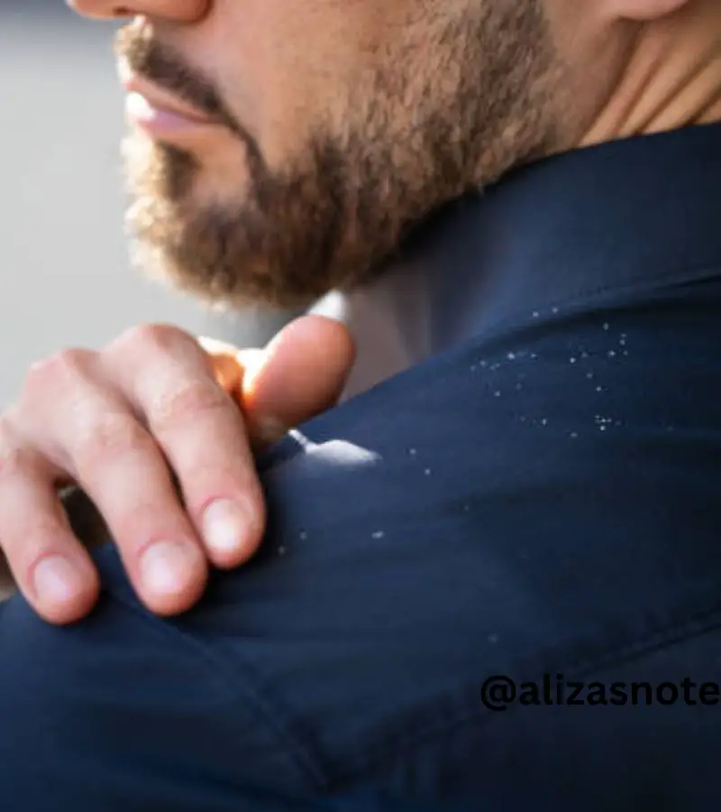 is it possible to remove dandruff permanently