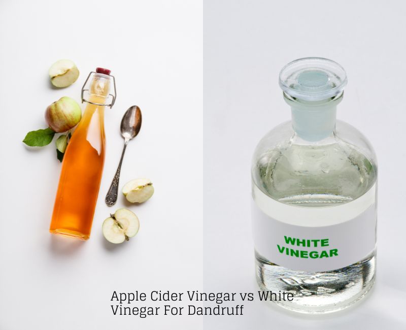 Apple Cider Vinegar vs White Vinegar For Dandruff