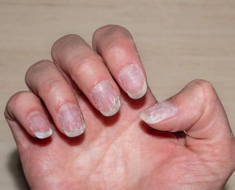 How To Fix Scratched Nails