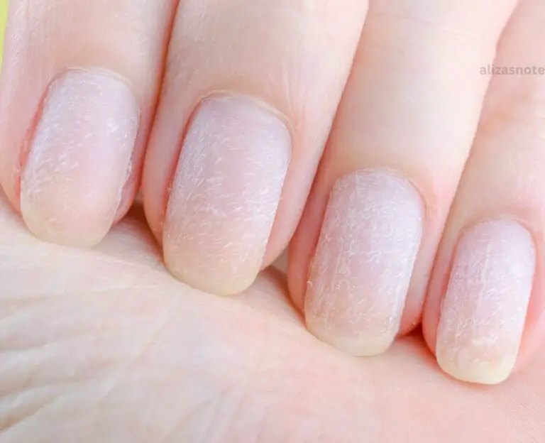 How To Treat Nails After Gel