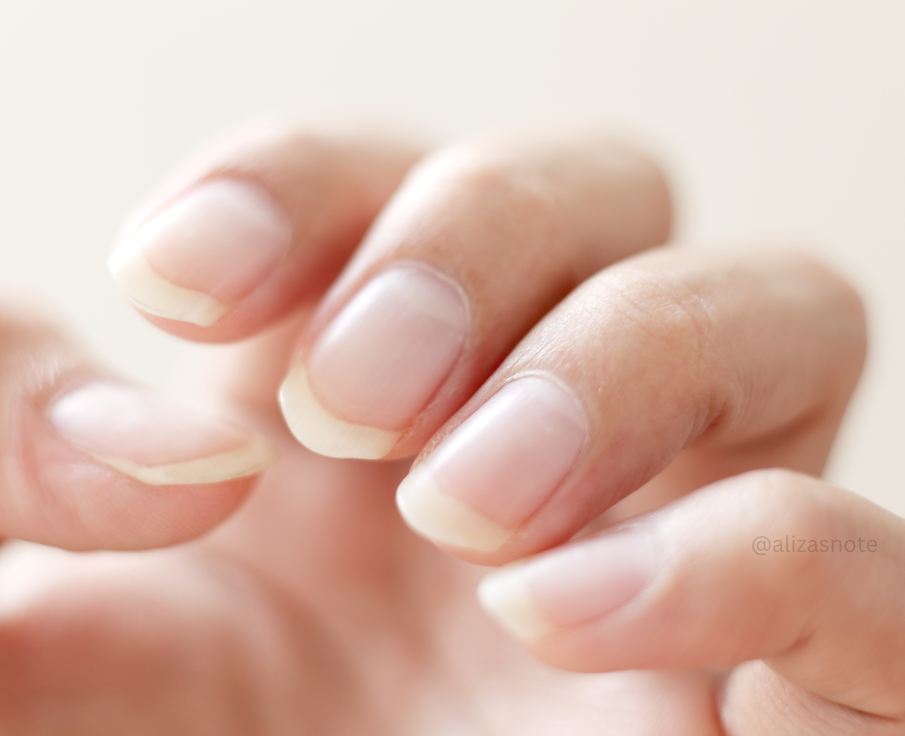 How To Treat Yellow Nails