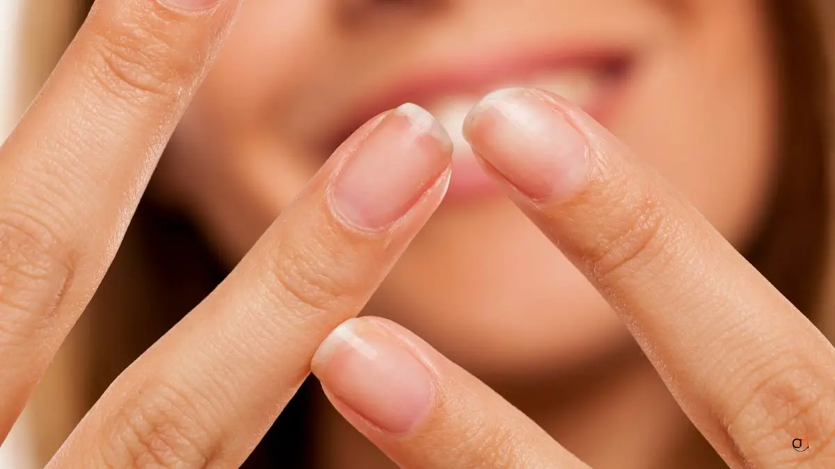 what causes fingernails to split down the middle vertically treatment